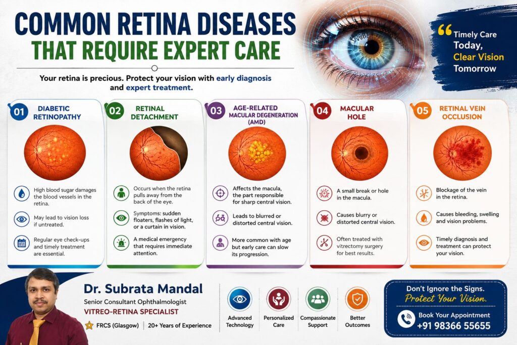 Common Retina Diseases