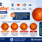 Diabetic Retinopathy: Symptoms, Stages & Treatment